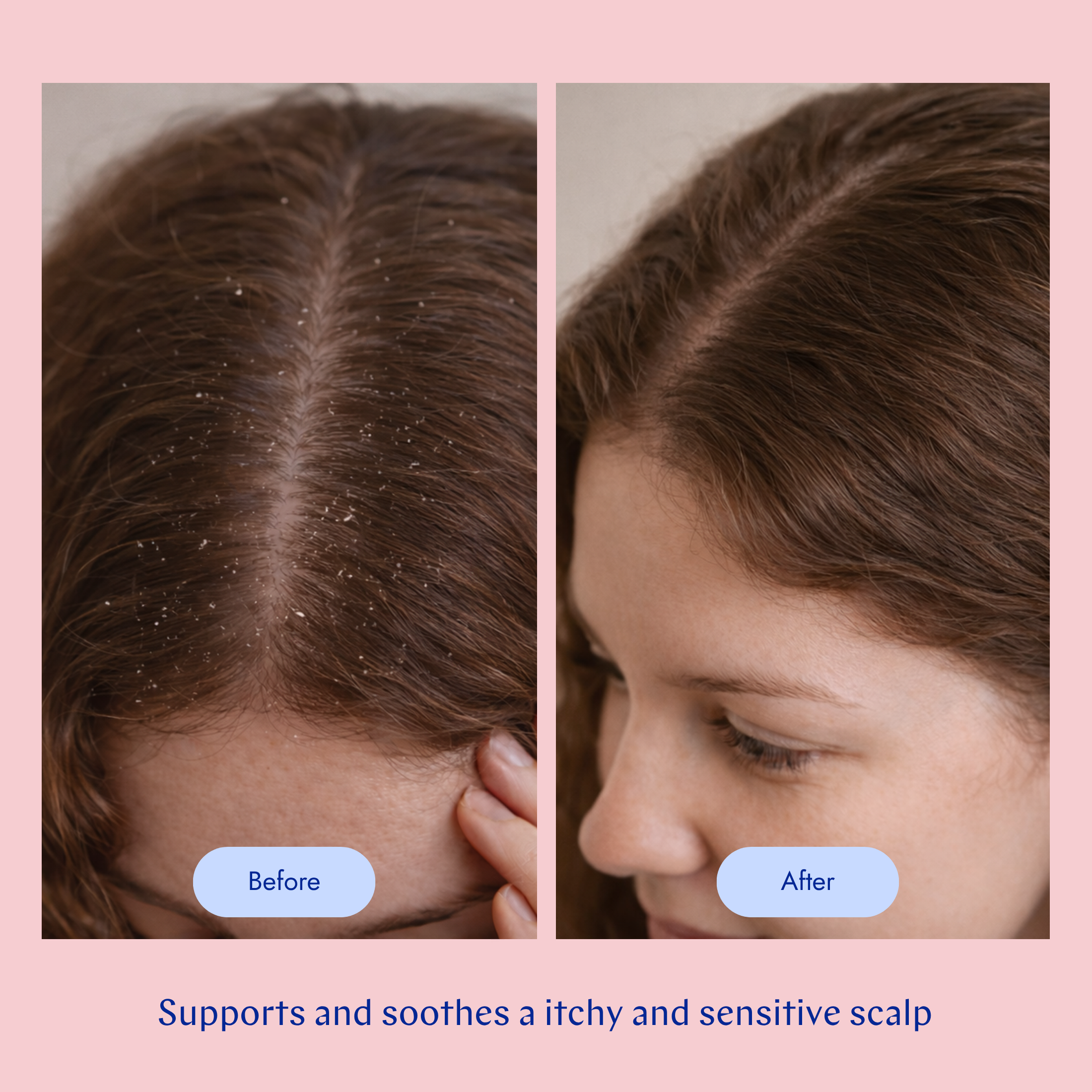 Scalp Care Masque